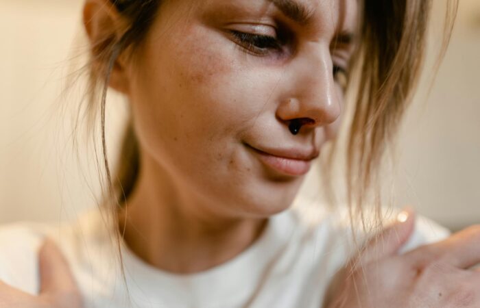 Mulher com a cara com sangue simbolizando violência domestica