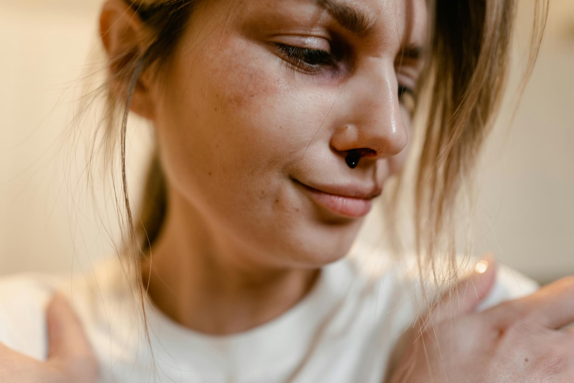 Mulher com a cara com sangue simbolizando violência domestica